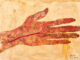 Linia Aniola